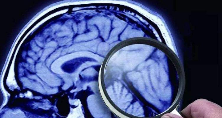 解决以恐惧的饥饿虚幻4崩溃的方法（应对游戏崩溃问题，恢复游戏稳定性）